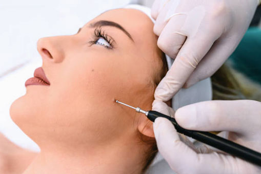 Mole and SKin Treatments